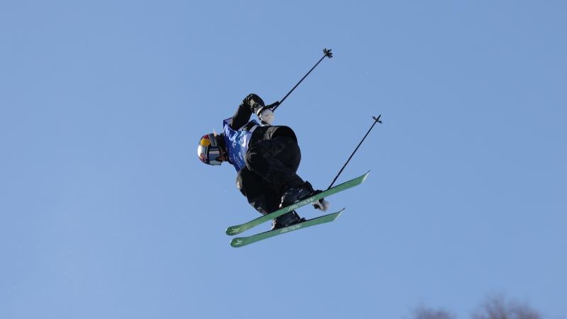 齐沃：对阵博洛尼亚的比赛会很艰难，恰尔汗奥卢能够上场（齐沃：迎战博洛尼亚将是硬仗，恰尔汗奥卢可以出战）